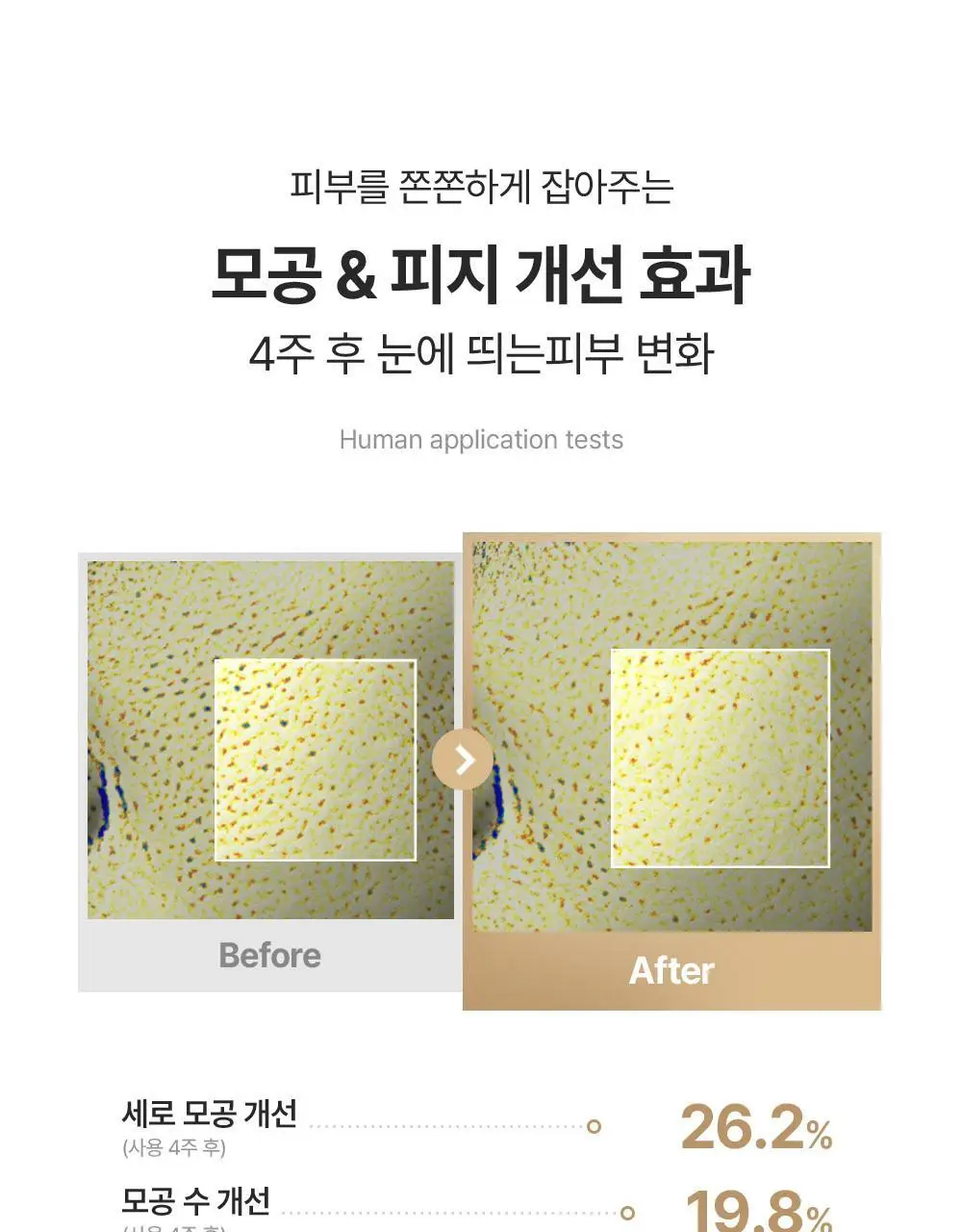 [올리브영 단독기획] 믹순 콩 에센스 50ml 기획 (+병풀 에센스 20ml) 상세페이지 13